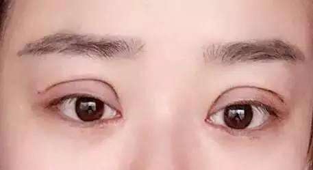 沈陽(yáng)于洪陽(yáng)光醫(yī)院是醫(yī)美整形專家？