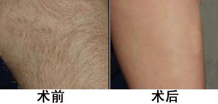 荊州好整形醫(yī)院排名前列的是哪家？