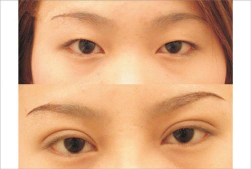 揚州整形隆鼻：揭秘2023前十強醫(yī)院，專業(yè)實力出眾！