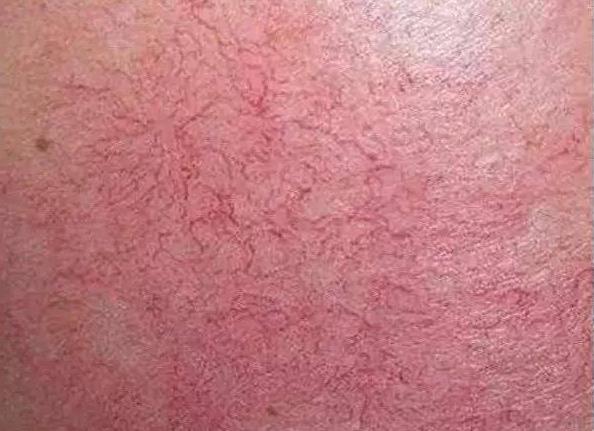 2023年鄭州最受贊譽(yù)的玻尿酸整形醫(yī)療美容醫(yī)院排行榜