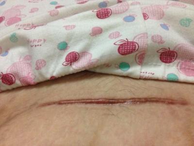 江門哪家整形美容醫(yī)院治療拉皮抬頭紋更專業(yè)2023江門大拉皮去抬頭紋醫(yī)院排行榜高質(zhì)量推薦！