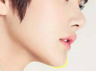 長(zhǎng)沙激光祛痘哪家醫(yī)院效果好，怎樣選擇適合自己的治療機(jī)構(gòu)？