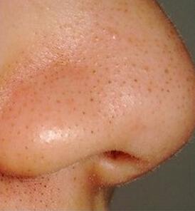 北京隆胸有哪些醫(yī)院可以選擇？是否有很多醫(yī)院提供隆胸服務(wù)？