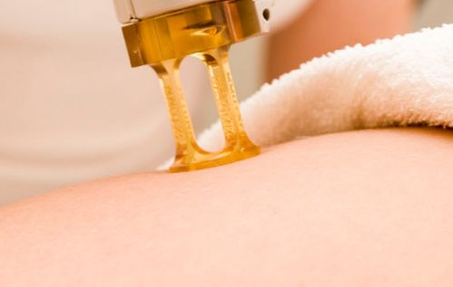 上海哪家醫(yī)院做陰唇整形效果好？