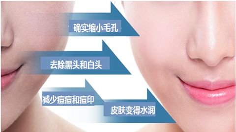 濰坊吸脂手術(shù)哪家醫(yī)院專業(yè)可信賴？2023領(lǐng)先三家醫(yī)療機(jī)構(gòu)實力揭曉