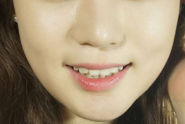 上海激光祛痣最好的醫(yī)院有哪些？