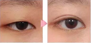 武漢哪家醫(yī)院做吸脂好？選擇正規(guī)醫(yī)院，打造完美身材！