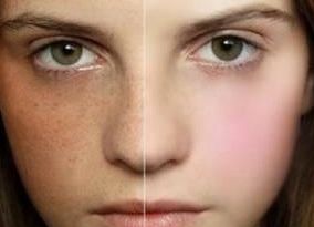 上海體表腫塊怎么辦？哪家醫(yī)院是專業(yè)醫(yī)治的？