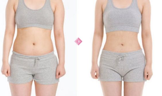 阜陽做眼袋手術(shù)，哪家醫(yī)院技術(shù)最好？