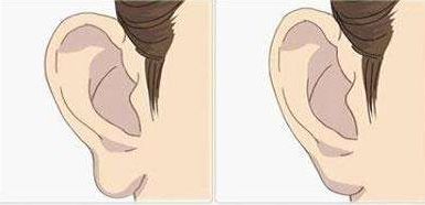 韓美雙眼皮手術價格到底受哪些因素影響呢？