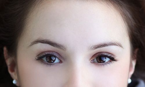 蘇州哪家醫(yī)院的光子嫩膚效果最好？