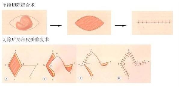煙臺(tái)醫(yī)療美容整形醫(yī)院，有哪些值得信賴(lài)的TOP5醫(yī)院？你該如何進(jìn)行明智選擇？