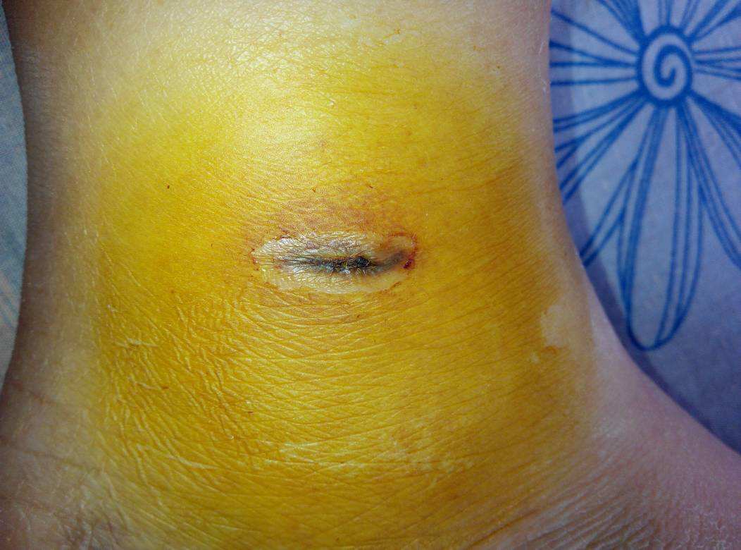 2023年十大成都微拉皮手術(shù)正規(guī)醫(yī)院排行榜發(fā)布！權(quán)威醫(yī)院名單曝光，口碑贊譽(yù)極高！