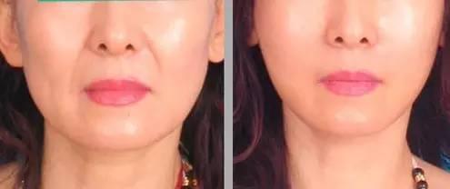 你想知道假體豐胸的效果和優(yōu)勢(shì)嗎？安全可靠的方式實(shí)現(xiàn)完美改變！