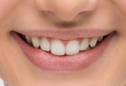 腰腹部吸脂是值得嘗試的嗎？有哪些需要了解的事項呢？