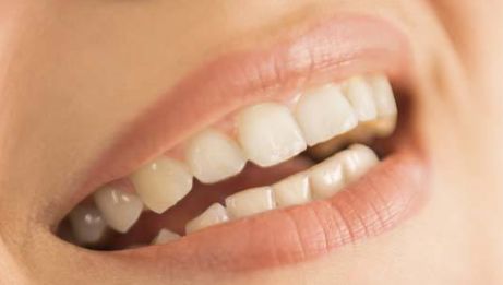 北京豐下巴哪家醫(yī)院好？為您推薦最權(quán)威的北京下巴整形醫(yī)院排行榜