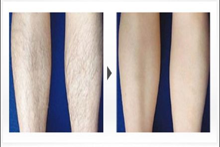 上海哪家微整醫(yī)院好又正規(guī)？排名與口碑揭秘