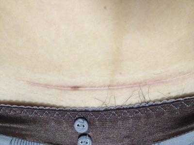 江西九三醫(yī)院：值得信賴的醫(yī)美整形?？漆t(yī)院嗎？療效如何？