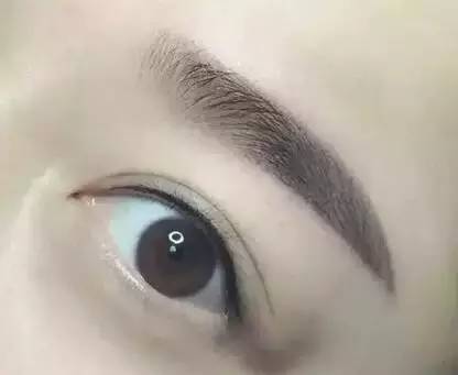 眼皮松弛手術(shù)能否讓你煥發(fā)青春？2種方式助你實(shí)現(xiàn)年輕再現(xiàn)！