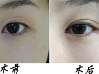 廣東省第二人民醫(yī)院美容科有哪些特色項(xiàng)目？醫(yī)生團(tuán)隊(duì)如何快速獲??？