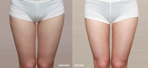 上海最好的削骨手術(shù)醫(yī)院有哪家？