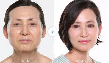 鹽城哪些醫(yī)院可以進行面部修復手術？曼麗莎醫(yī)院面積達3000平方米