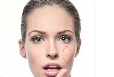 煙臺眉弓整形醫(yī)院指南：精選前十