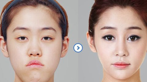 廣州中家醫(yī)黃廣香隆胸術(shù)：價(jià)格公開+專家聲譽(yù)+技術(shù)口碑詳解