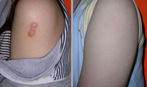 成都去眼袋哪家醫(yī)院好？十大佳選驚艷出爐！