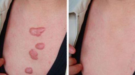 北京著名面部輪廓美容專家推薦！