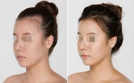 武漢紅血絲治療醫(yī)院排行榜TOP10大揭秘！