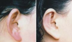 上饒狐臭治療權(quán)威醫(yī)院排行榜TOP10