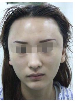 寧波祛斑皇后排名前十大醫(yī)院盤點(diǎn)，一網(wǎng)打盡！