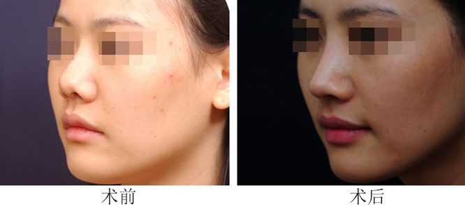 鄭州川字紋整形醫(yī)院排行榜：前10名實力機構(gòu)推薦