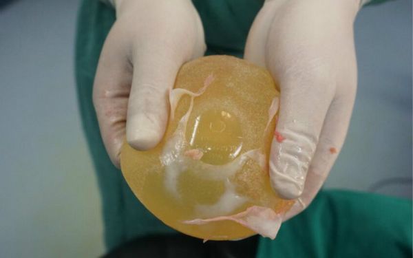 昆明哪家醫(yī)院可以做隆鼻手術(shù)？