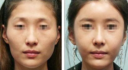 詳解成都十家口碑靠前的祛頸紋整形醫(yī)院