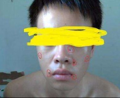 北京額頭提拉術(shù)醫(yī)療整形醫(yī)院排名及口碑TOP10！