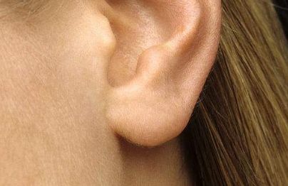 長(zhǎng)春激光祛除表情紋排行榜揭曉：醫(yī)療美容機(jī)構(gòu)前十強(qiáng)公布！