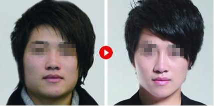 2024年北京醫(yī)療美容醫(yī)院排名及點(diǎn)陣射頻技術(shù)評(píng)估榜單