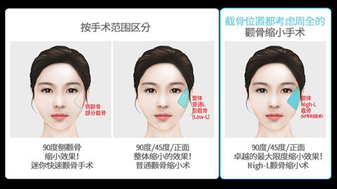 長沙乳房整形巔峰醫(yī)院排行榜公布！湘雅三院、亞韓、協(xié)雅等，十大對比曝光！