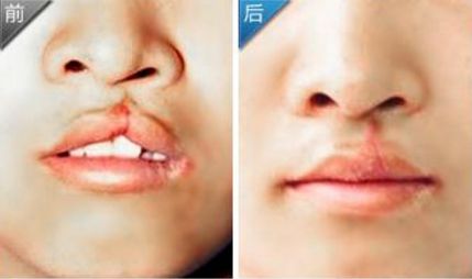 廣西口碑優(yōu)異的10家肩頸護(hù)理醫(yī)院，實(shí)力不容小覷！