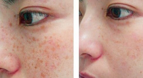 2023南昌隆鼻整形醫(yī)院榜單公布！南昌九三關(guān)懷醫(yī)院、大學(xué)附屬眼科站穩(wěn)前三位置