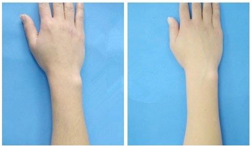 2023天府之國成都隆鼻技術(shù)精湛，實(shí)力醫(yī)生名單揭秘！