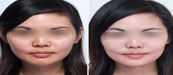 天津最佳凹陷疤痕修復整形醫(yī)院排行榜及評價