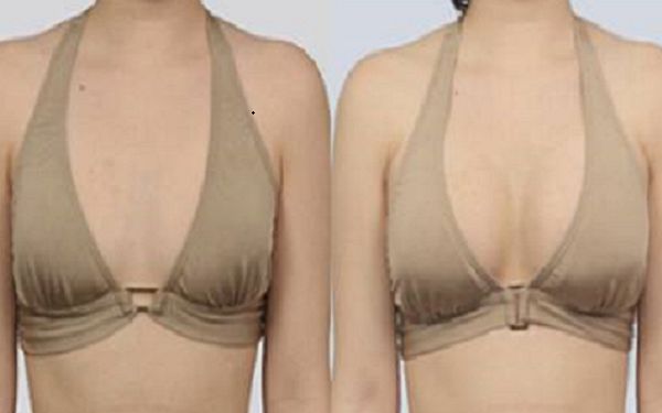 寧波微針除細紋口碑卓越 美容名家匯聚