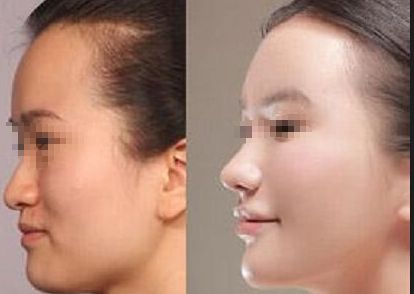 溫嶺祛除眼部細(xì)紋：醫(yī)院齊聚榮耀榜