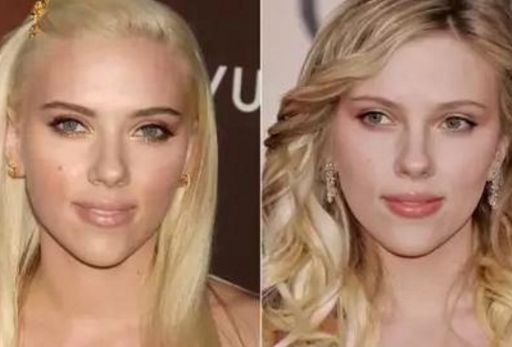 洛陽(yáng)十大口碑表情紋改善醫(yī)院排名揭曉！