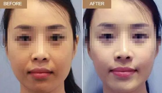 濟南微整形川字紋口碑排名前10醫(yī)療美容醫(yī)院大揭秘！