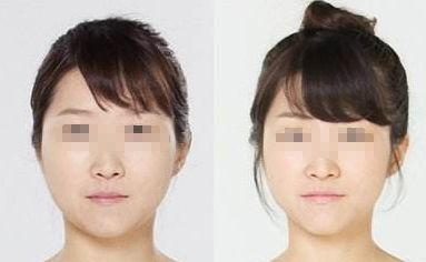 青島十大正規(guī)美容醫(yī)院推薦，維拉塑身早早上新！