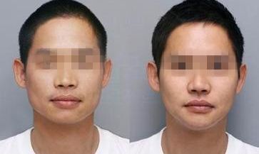 金華哪家眼部肌膚醫(yī)院好？排名榜揭秘